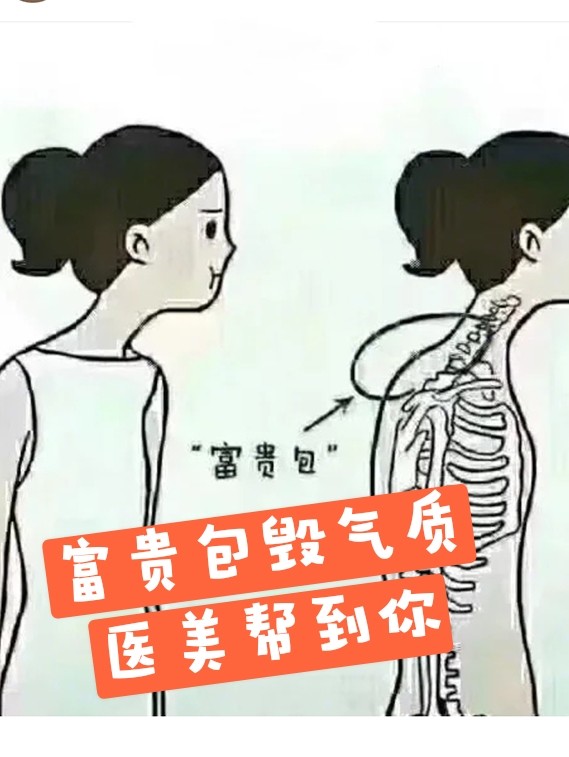 医美手段怎么去富贵包