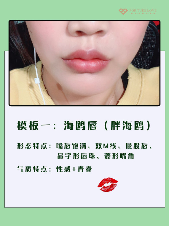 最受欢迎的嘴唇整形模板