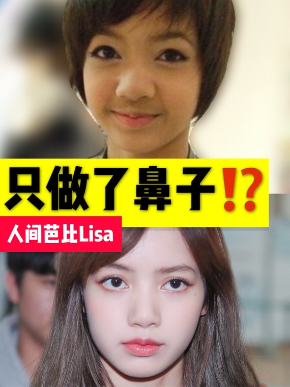 有人说lisa只整过鼻子,你信么?-有一些人拿li_圈子