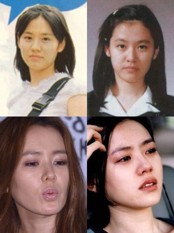 在韩国网站上看到孙艺珍的旧照,就是整容前的照片,她整容之前的脸上