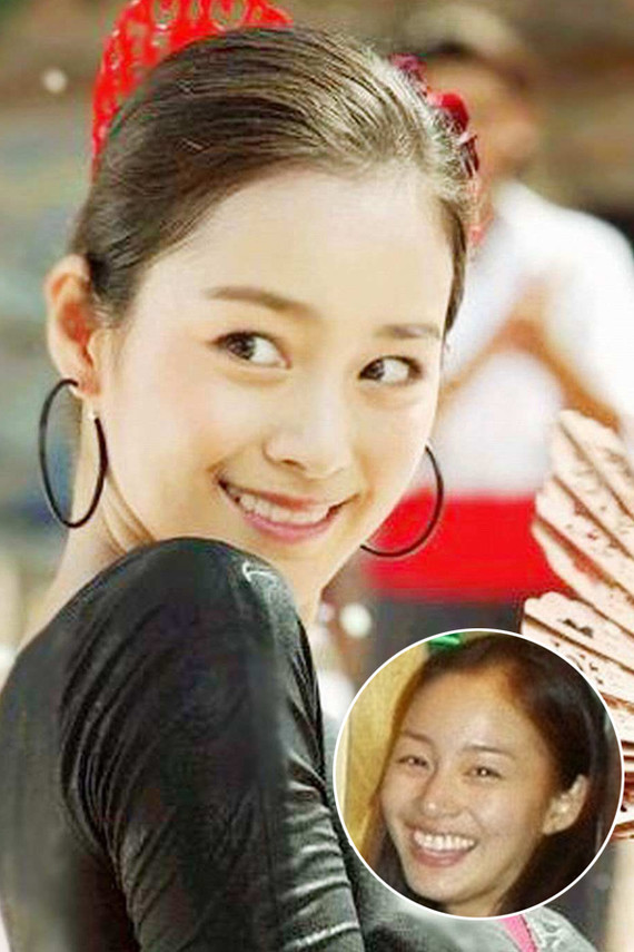韩国第一美女金泰熙,也是做过牙齿矫正的哦~9797