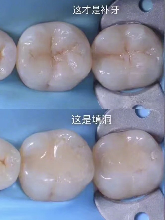 大家仔细观察过一个殉葺吗?
