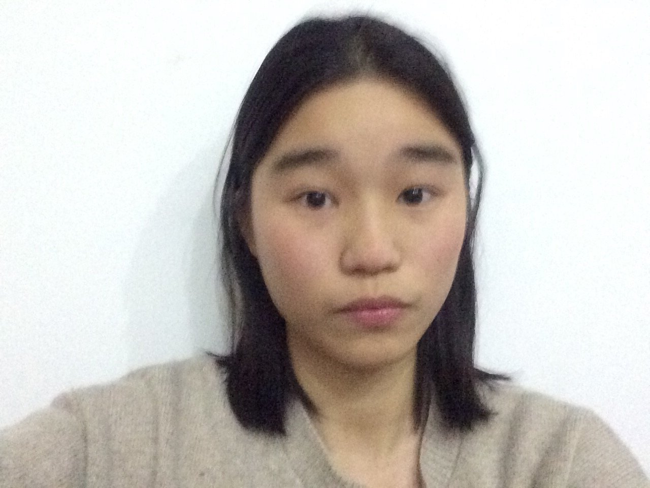 脸大且方颧骨凸出额头短鼻梁低脸部留白多大小眼需要整容吗还是可以