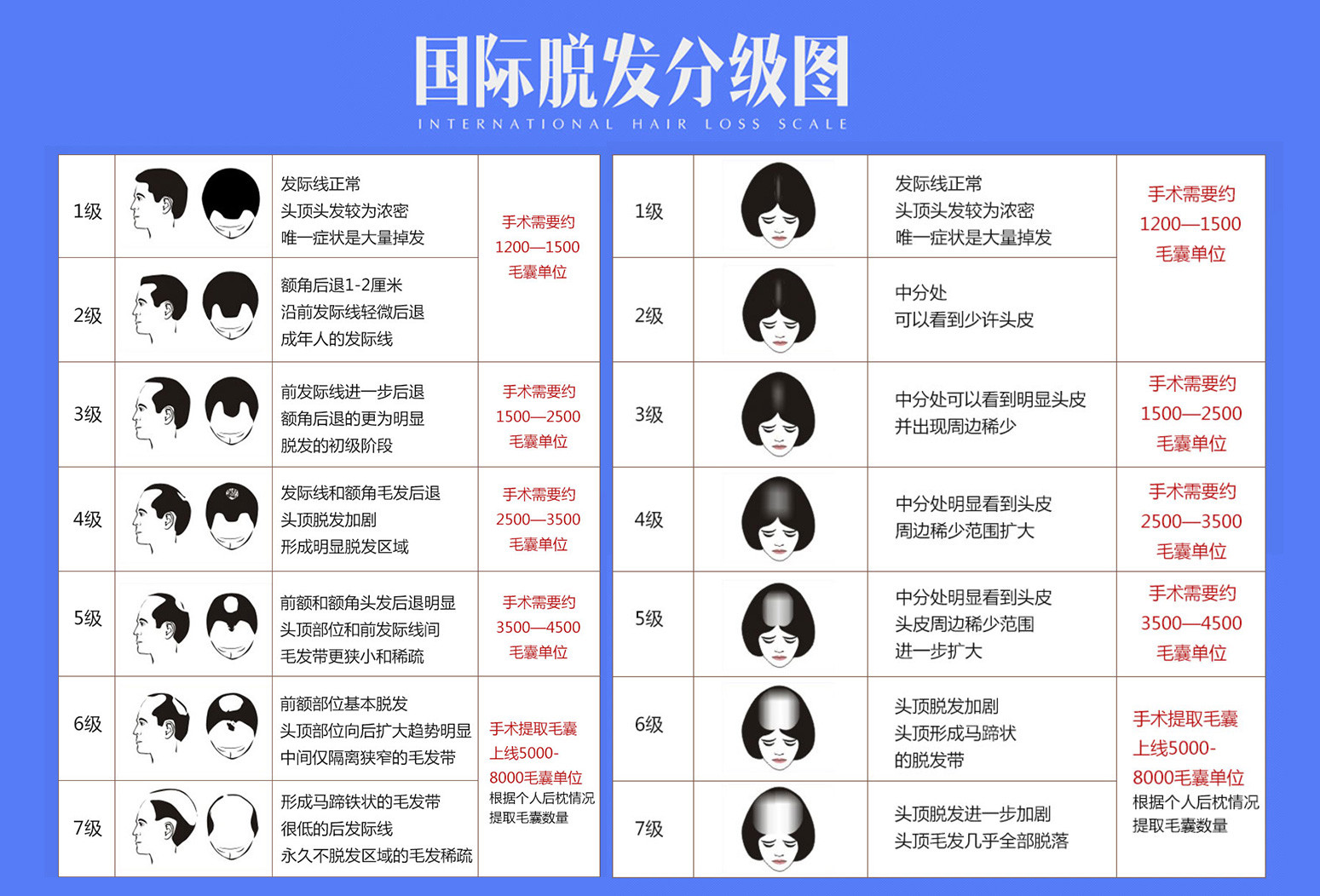 种植头发大概要多少钱种植头发价格表