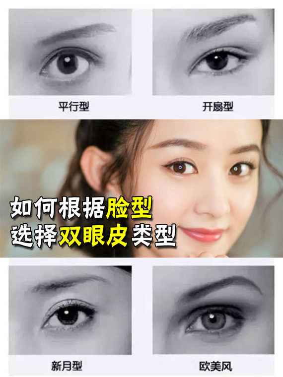 双眼皮越宽越好?小心变成悲伤蛙表情包!
