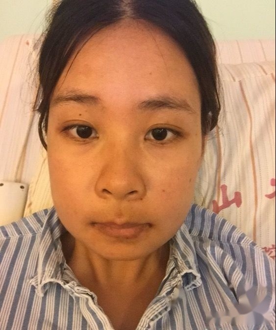 由于龅牙大嘴,经常被人说长得太丑!