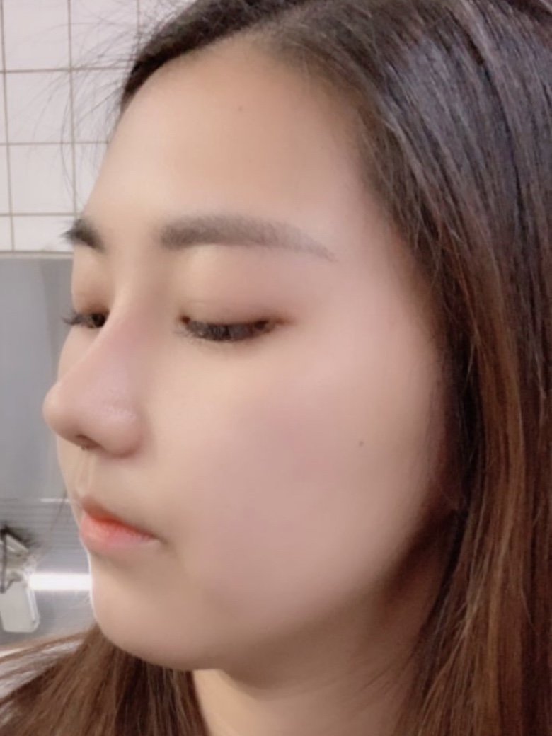 整个人气质深受影响,看起来有些土气,真的太难看了,有的人说这是福鼻