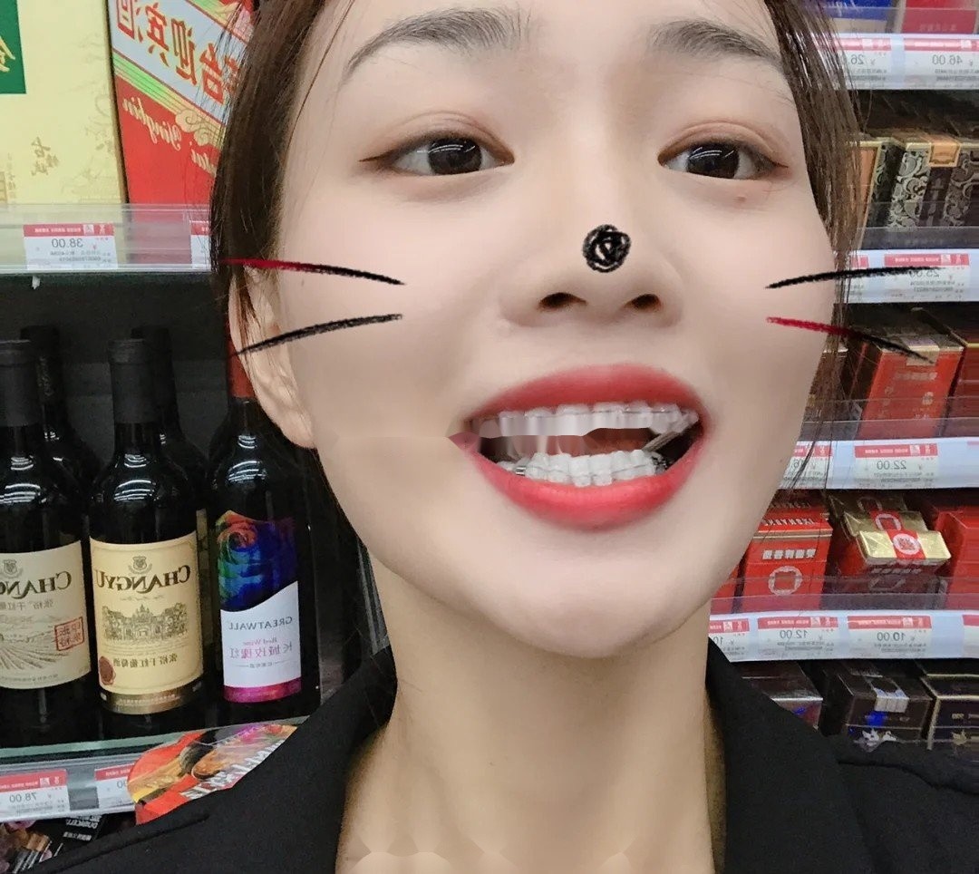 小姐姐牙齿情况