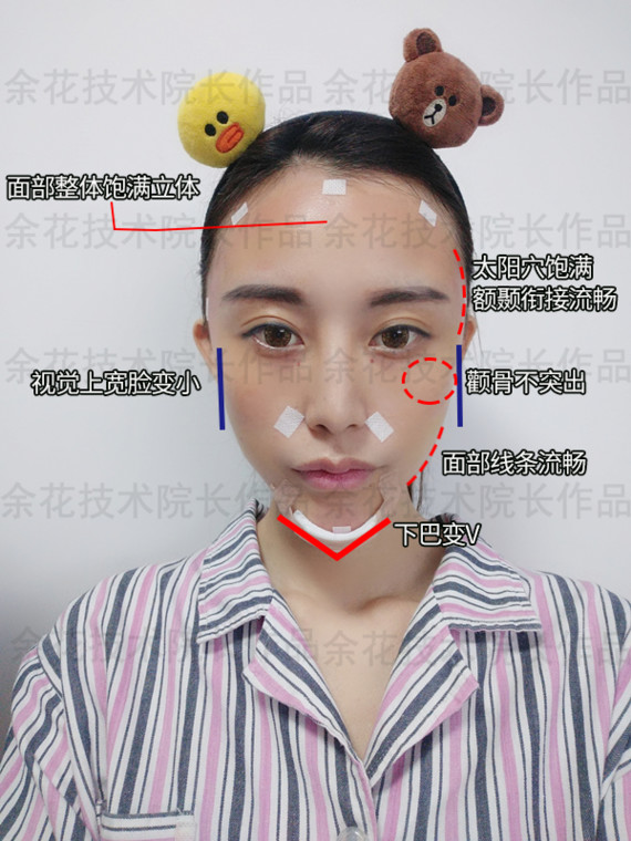 宽脸骨相的刻薄girl,非得动骨才能变得柔和吗?