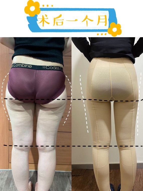 臀线,就是臀部和腿部的过渡而形成的结构凹陷