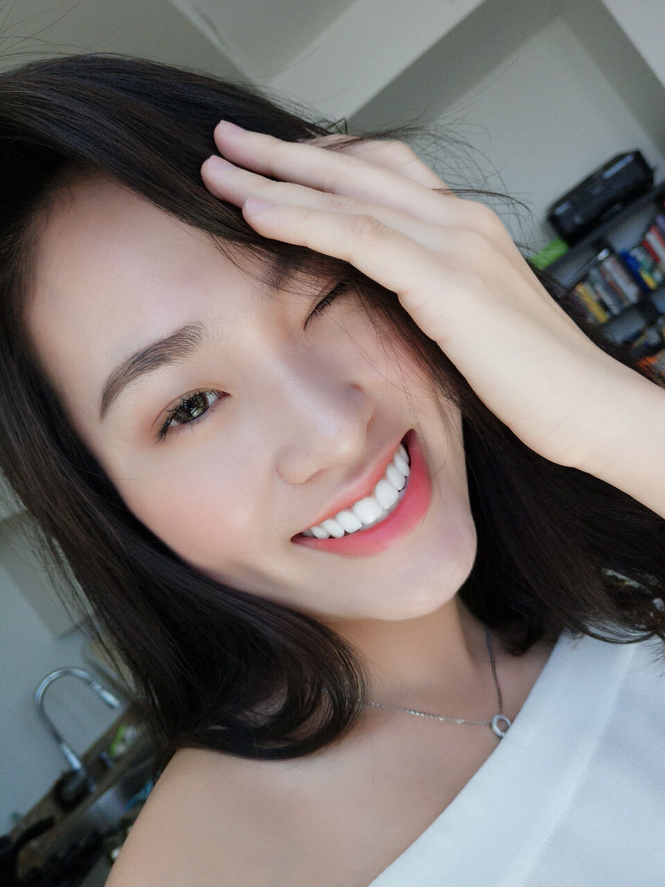 分享一个小姐姐的美牙经历