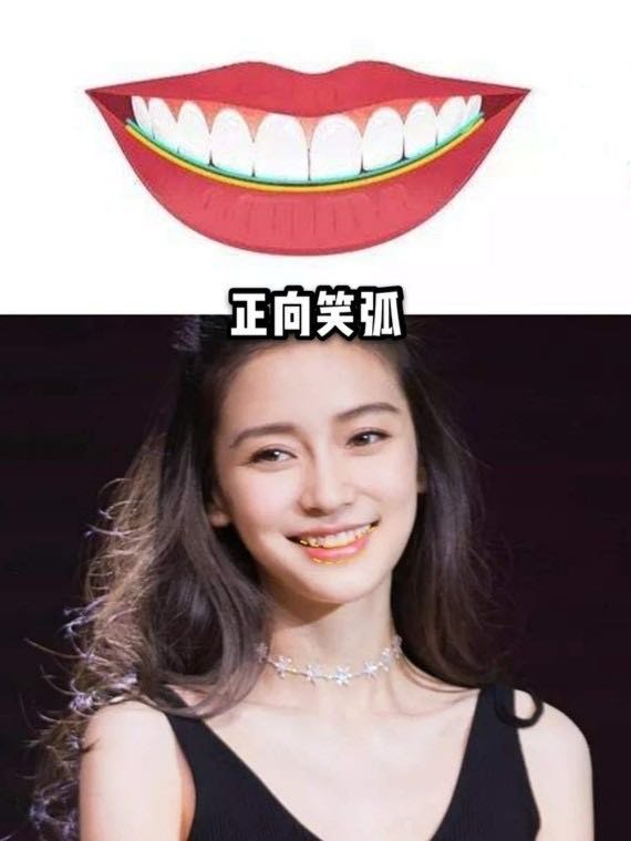 从美术的角度理解,笑容也是线条的构成,也就是上下唇曲线和牙齿曲线的