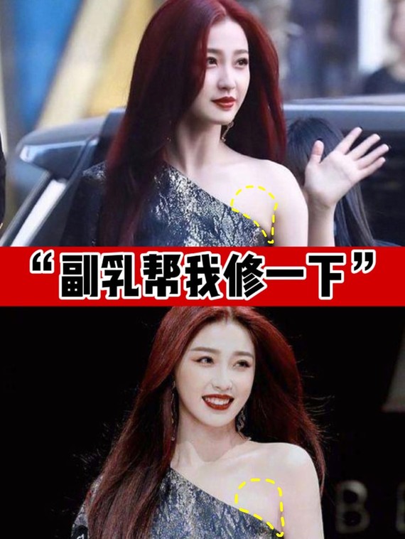虞书欣"副乳帮我修一下",有副乳怎么办?有了副乳,_圈子-新氧美容整形