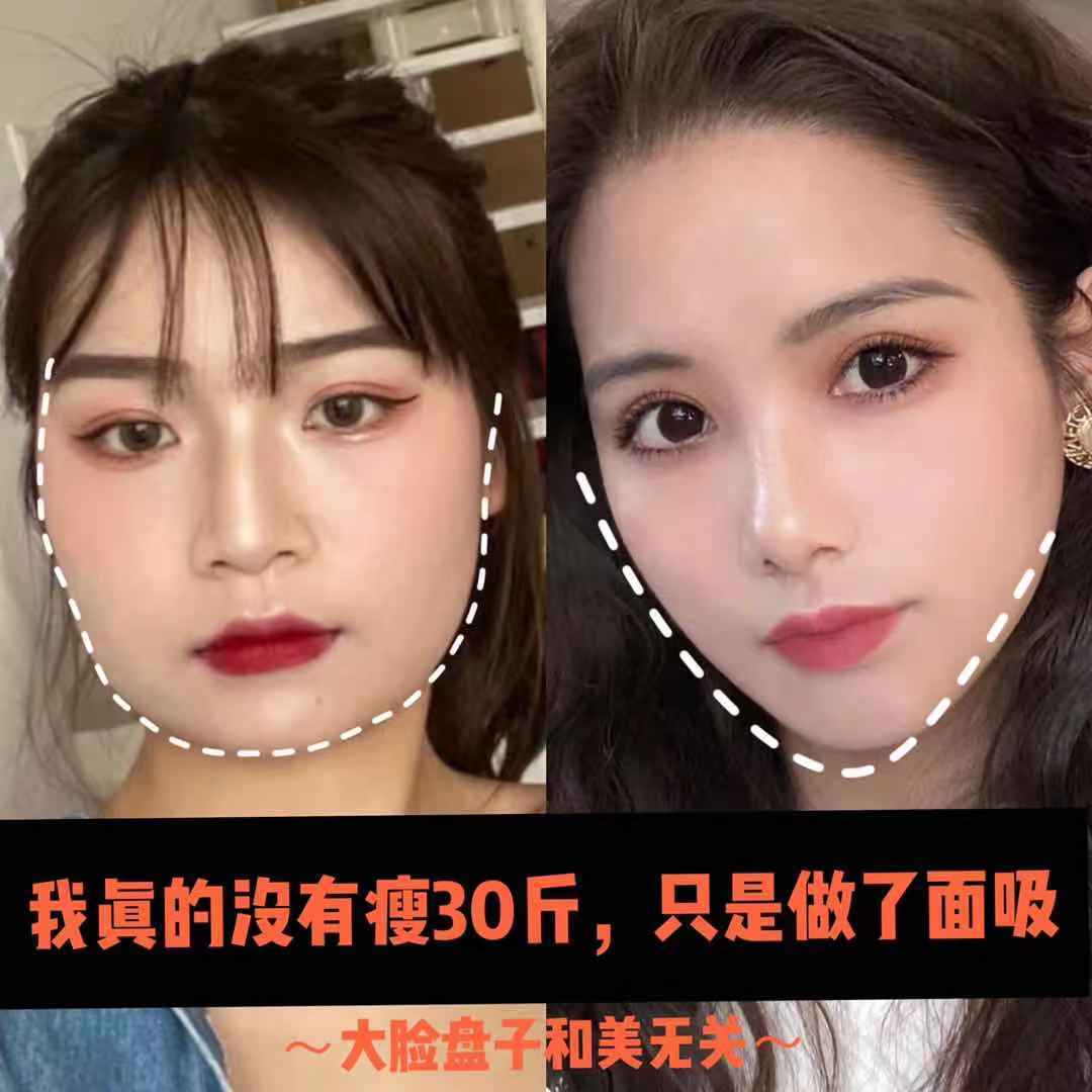 大脸盘子与美无关!