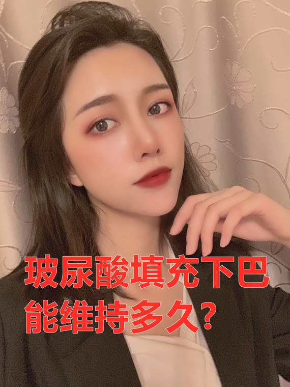 玻尿酸填充下巴能维持多久?