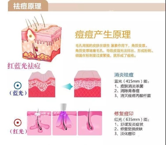 春节狂吃熬夜长痘不断这样急救摆脱痘痘肌