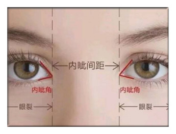 根据内外眦的位置高低,可以将眼睛分为水平型,上翘型和下倾型.