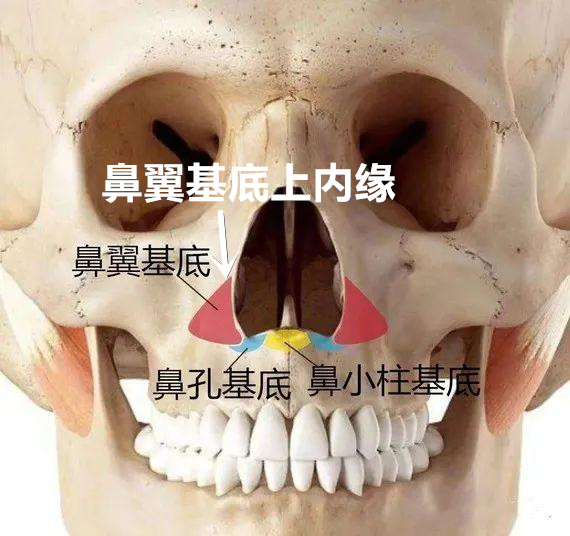 垫鼻基底后鼻孔朝天是哪里出了问题