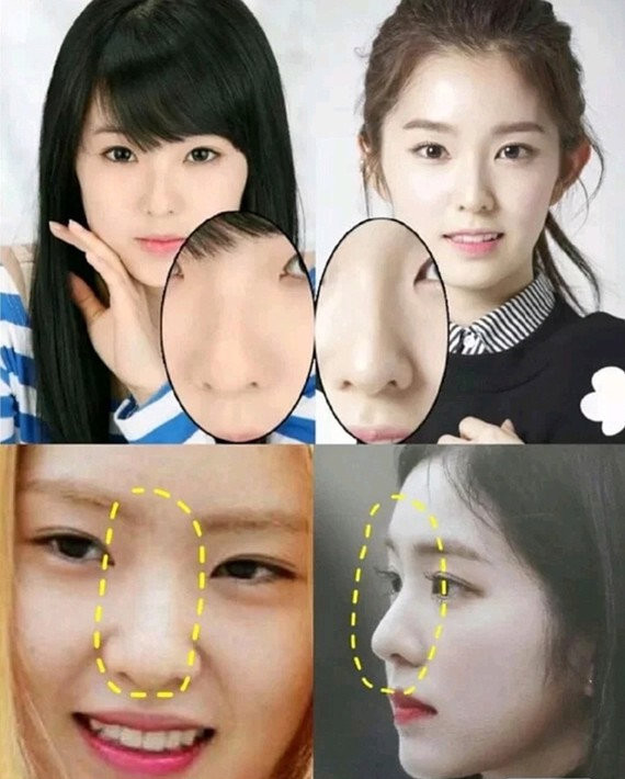 有妈生整容模板之称的裴珠泫,也是整过的!