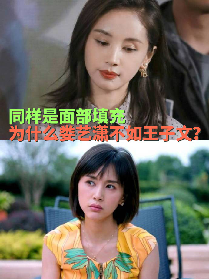 同样是面部填充,为什么娄艺潇不如王子文?