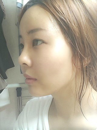 从侧面看也非常漂亮吧,但是一点,还是觉得颧骨前突.