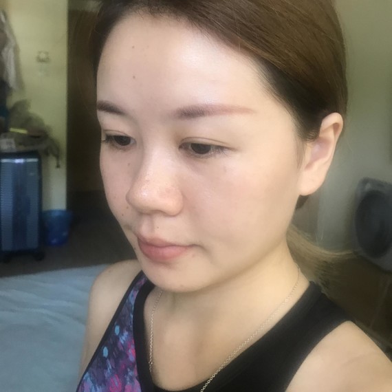 侧面真好看仰拍也好看鼻孔超对称鼻翼窄了鼻头小了虽然_圈子-新氧美容