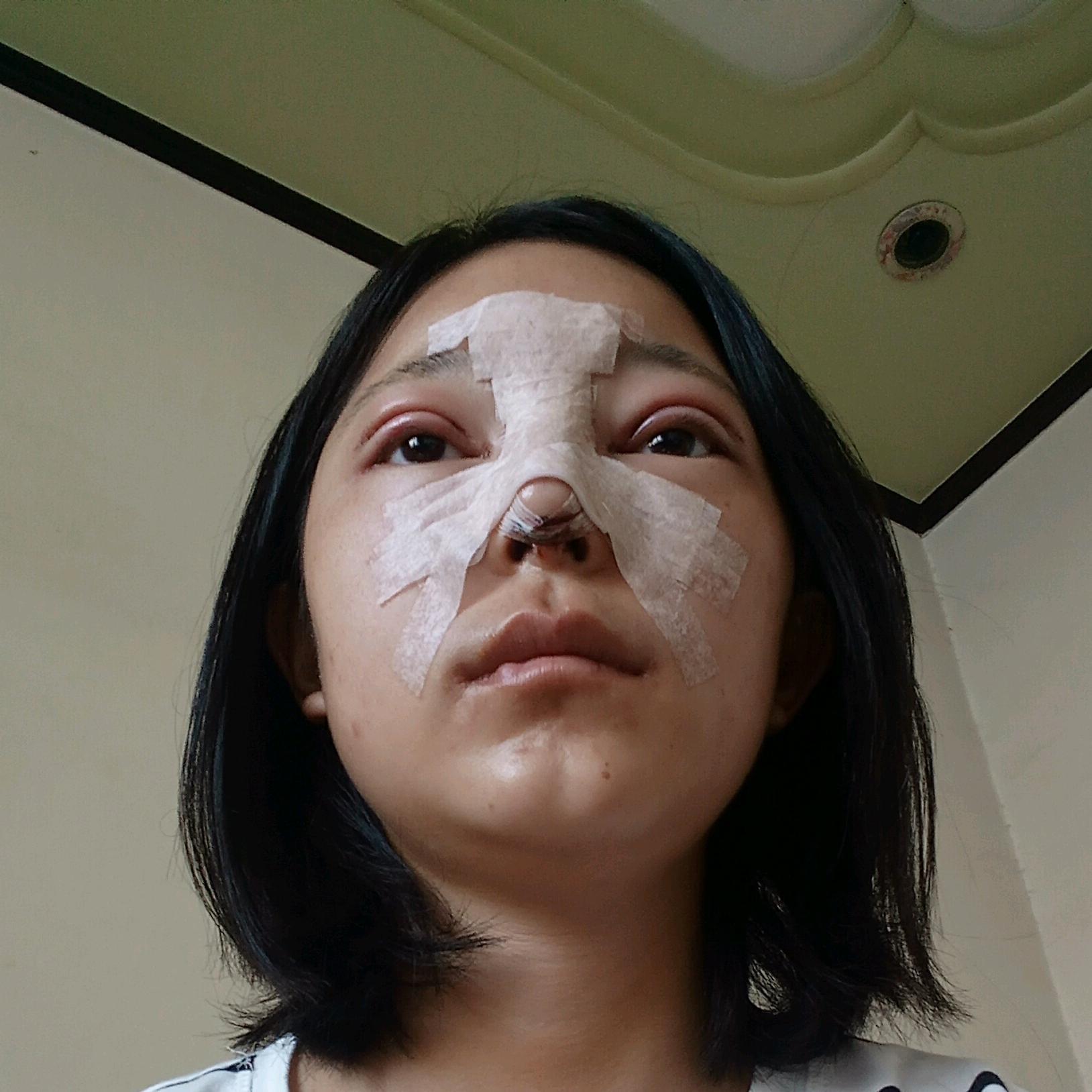 沈圆圆的个人主页 - 新氧整形