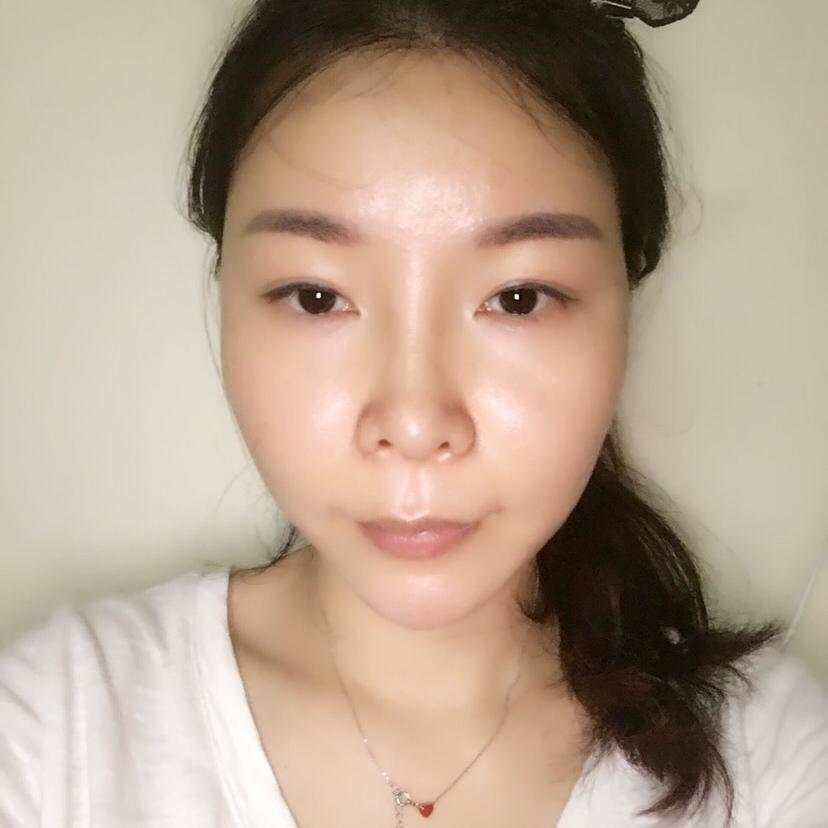 刘湘医生的整形案例,整形对比照片-新氧约惠