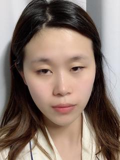 韩国必妩整形医院金正敏医生日记 用户案例 新氧美容整形