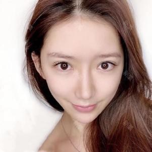 大家好,请叫我小可爱,我原本属于就比较小巧玲珑的那_圈子-新氧美容