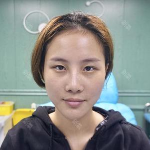 【水光针】海珠水光针(2ml) 其他 ,海珠水光针2ml vitc 2ml  prp3ml