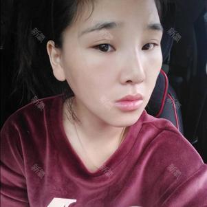 永永秦晴的个人主页 新氧整形