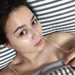 vivibabe的个人主页 - 新氧整形