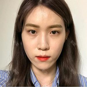 【除皱瘦脸】保妥适 除皱瘦脸 100单位 ,【私信减200元】进口botox