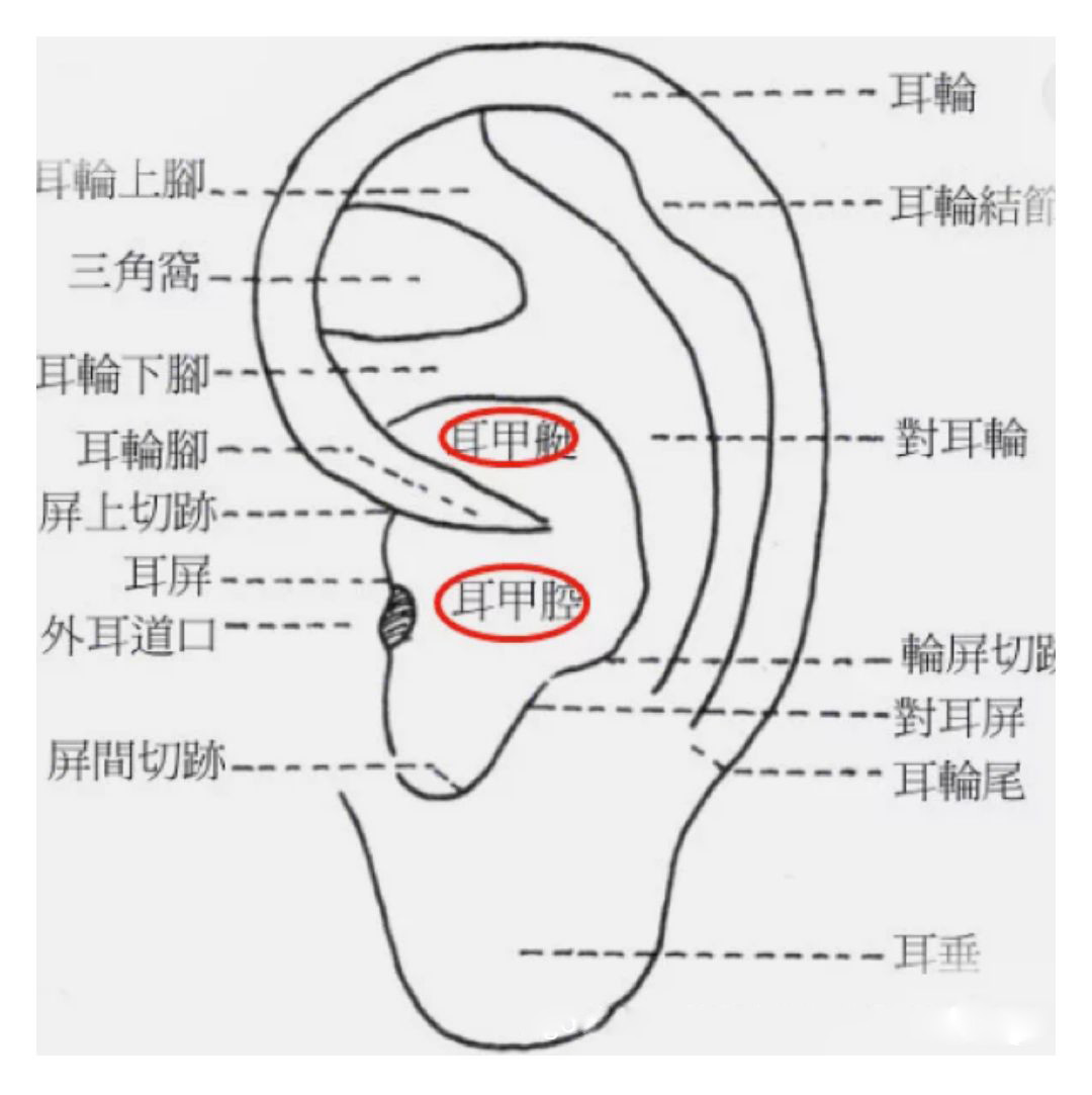 耳屏长痣图解图片