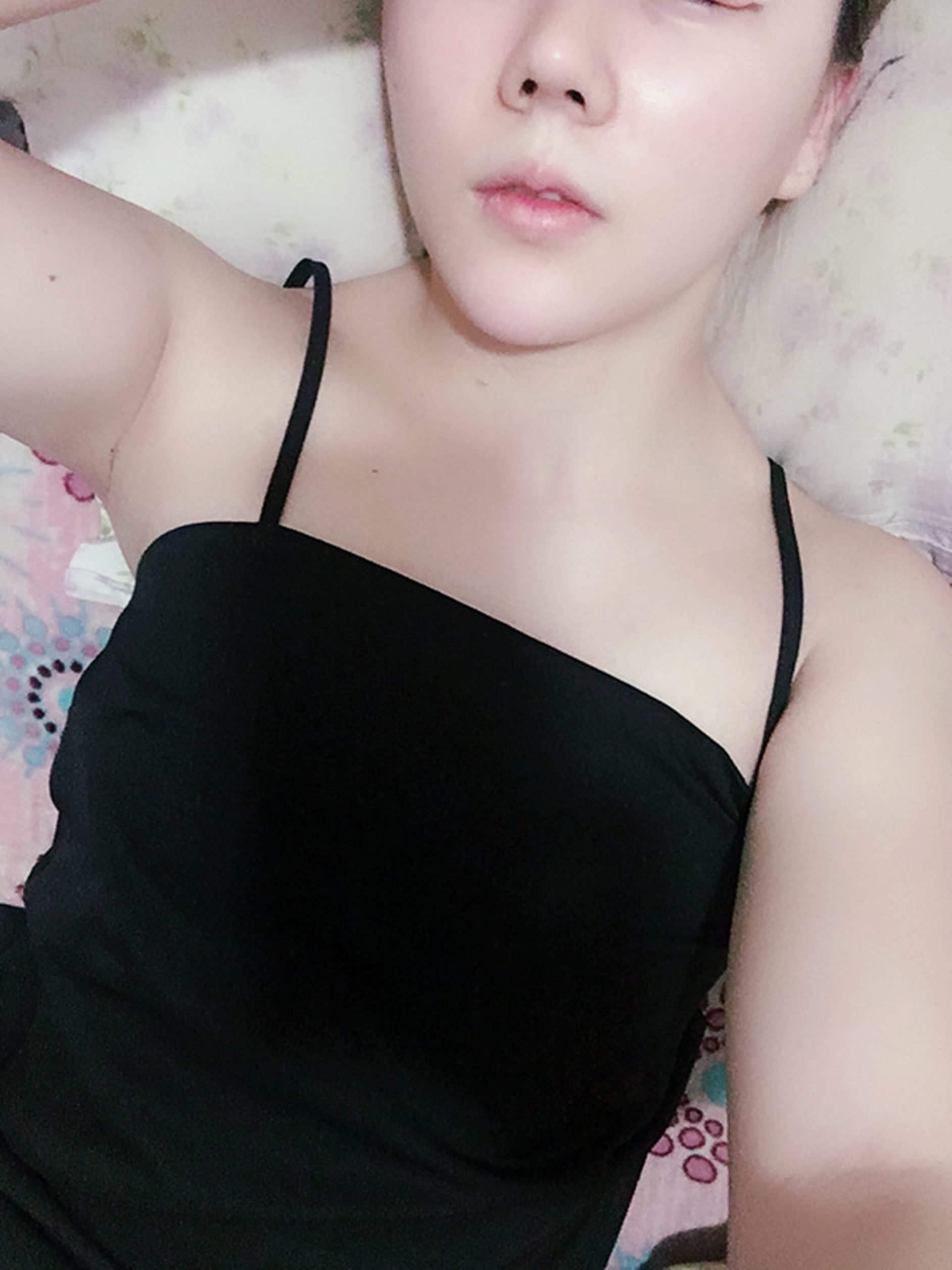 经乳房下皱壁胸围约74cm, 经乳头胸围的84cm, 乳房上极胸围约83cm.