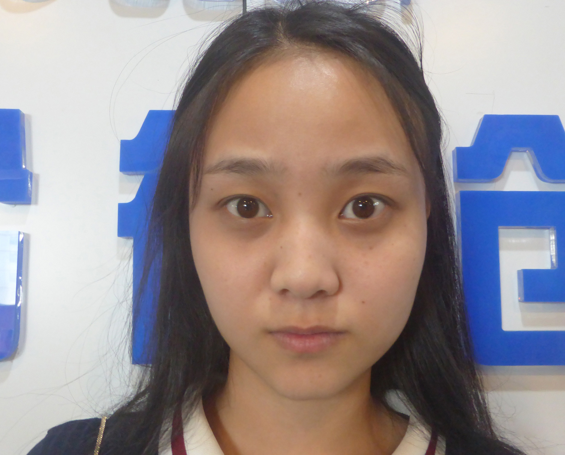 睑裂宽度比例适当,属于杏眼,一般多为内双,为了突出清纯娇憨之感,设计