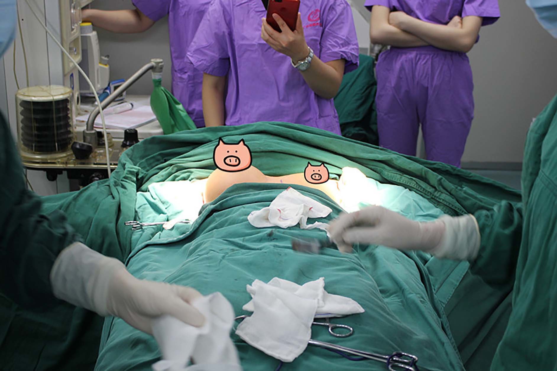 变性手术模具隆胸图片
