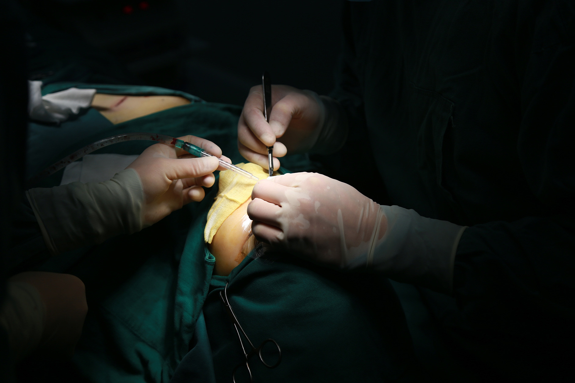 刘明飞的诊断报告