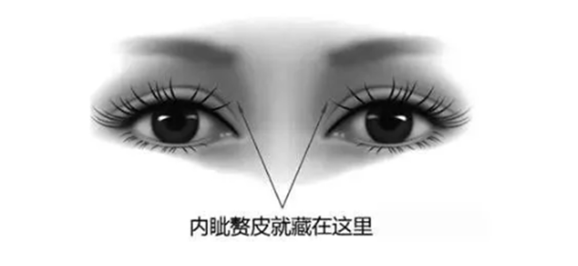 并且有内眦赘皮.