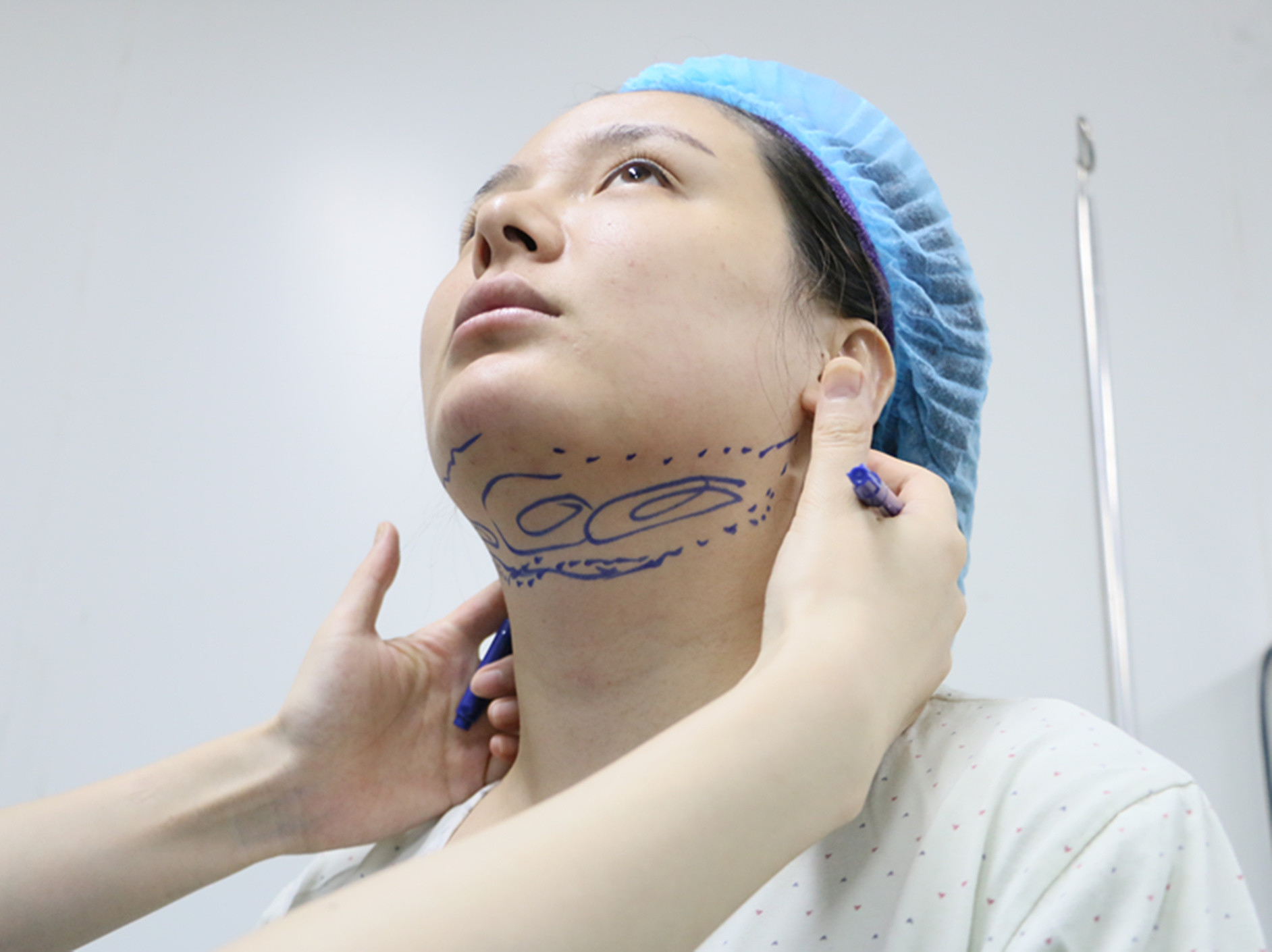 术后缝合包扎,外敷纱布加压包扎. 5.半小时