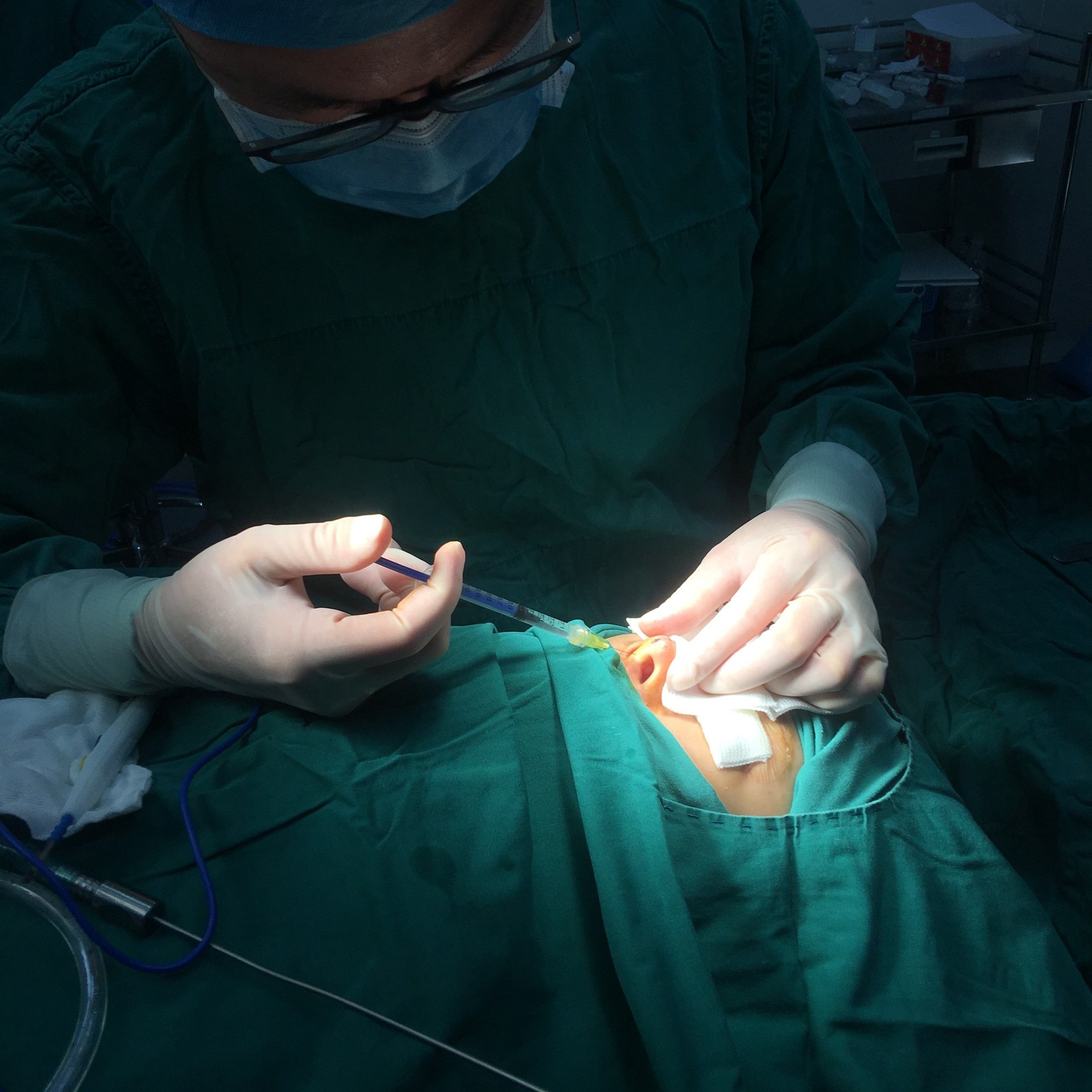 好假体位置,并将分离出的双侧大翼软骨及内侧脚提拉并固定于假体上,取