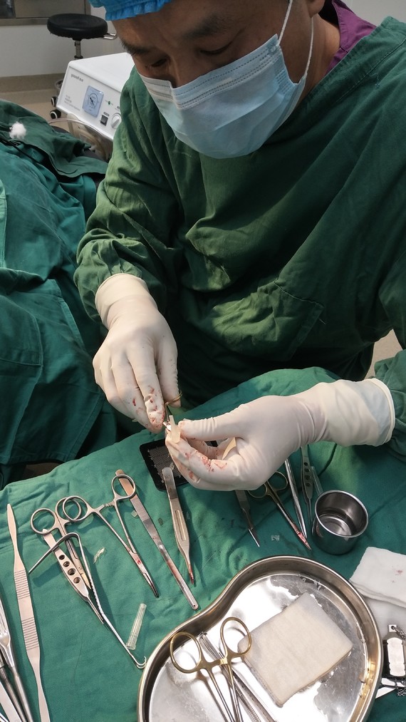 手术时长3 小时 术前照片术后照片报告亮点硅胶假体_圈子-新氧美容