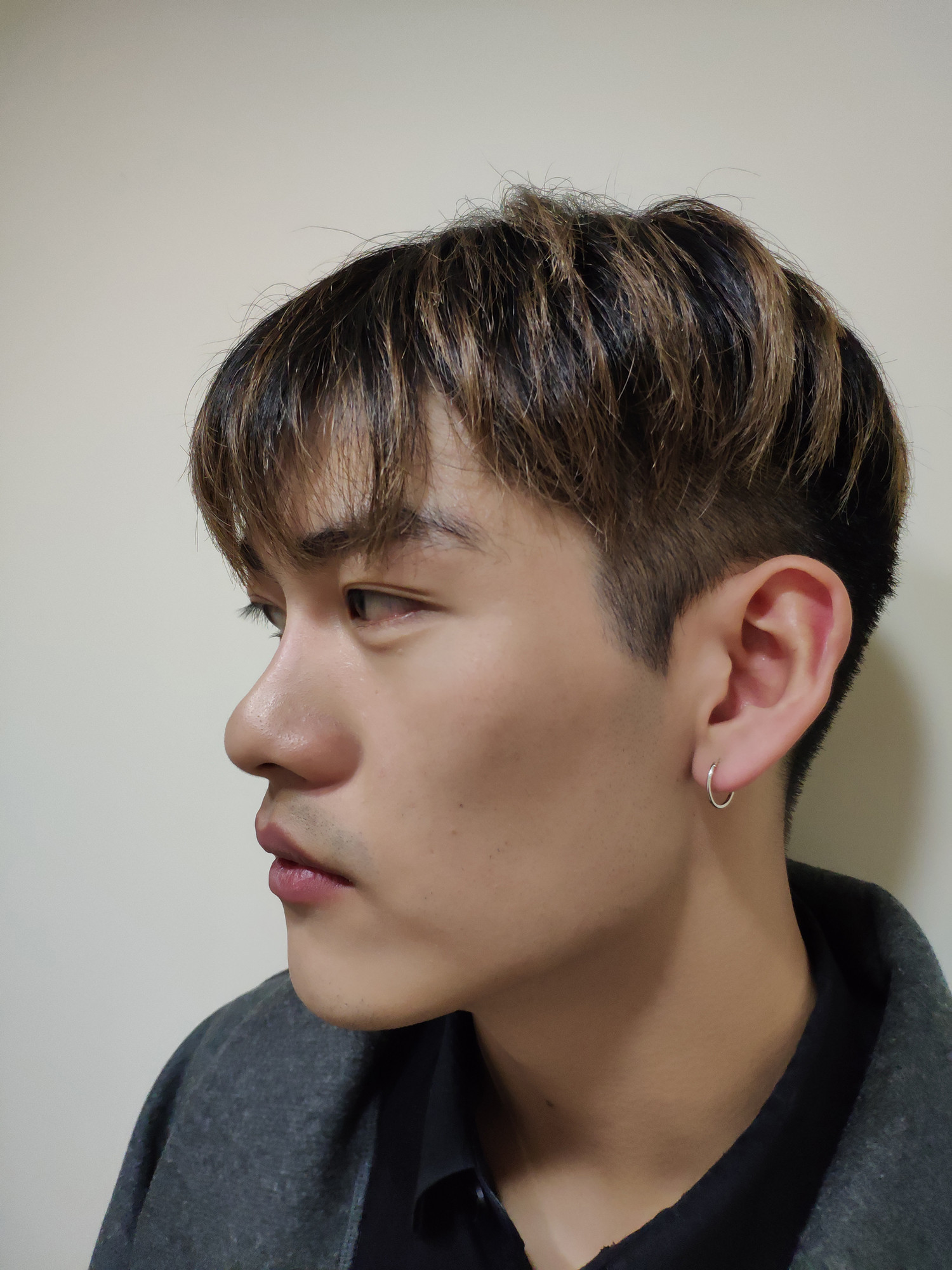 肥厚 2,鼻基底凹陷,鼻梁不够高 3,两侧鼻孔略微有点不对称,侧面鼻子短