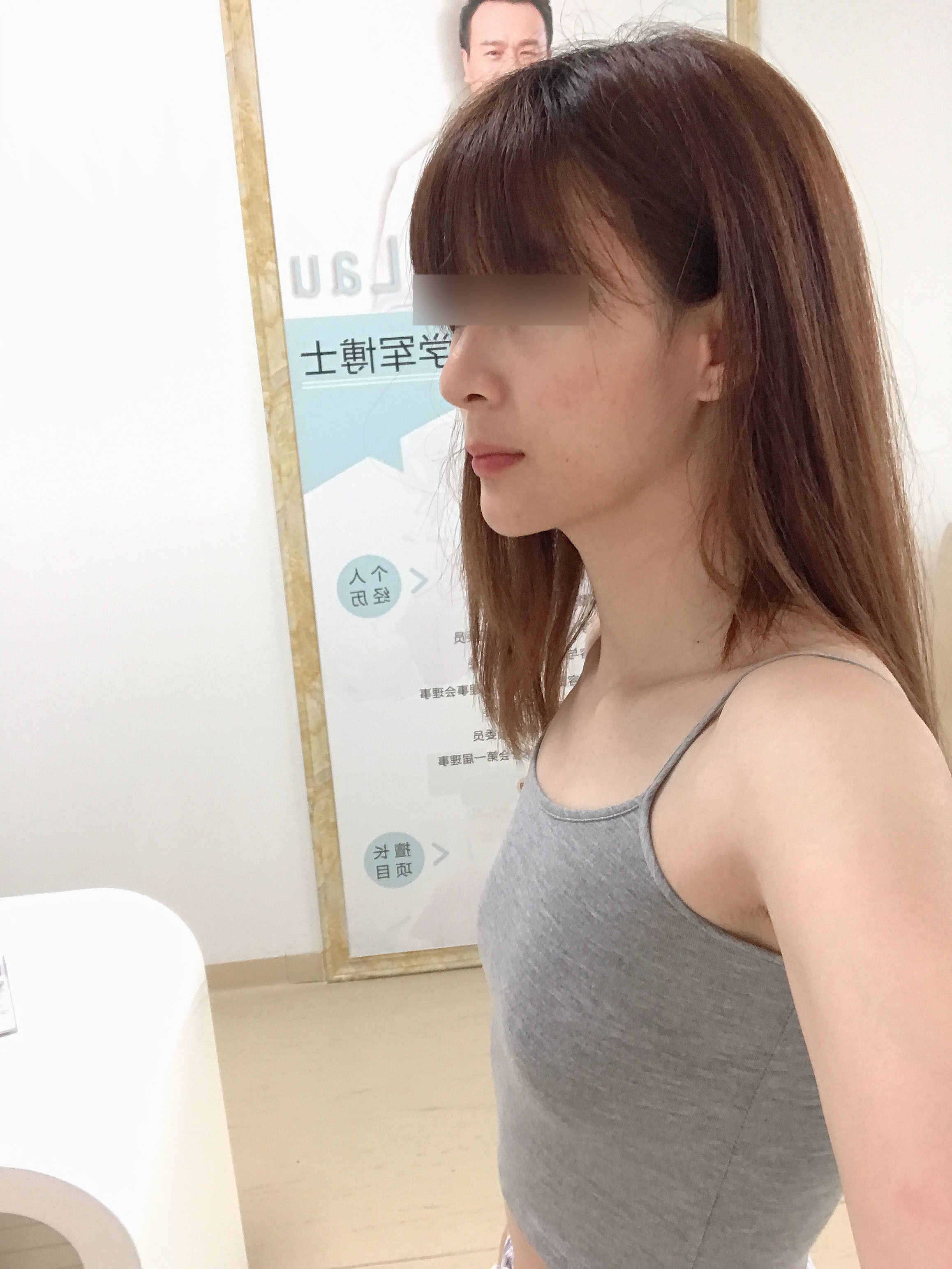 术前数据诊断: 1.乳房底盘直径:8~10cm; 2.