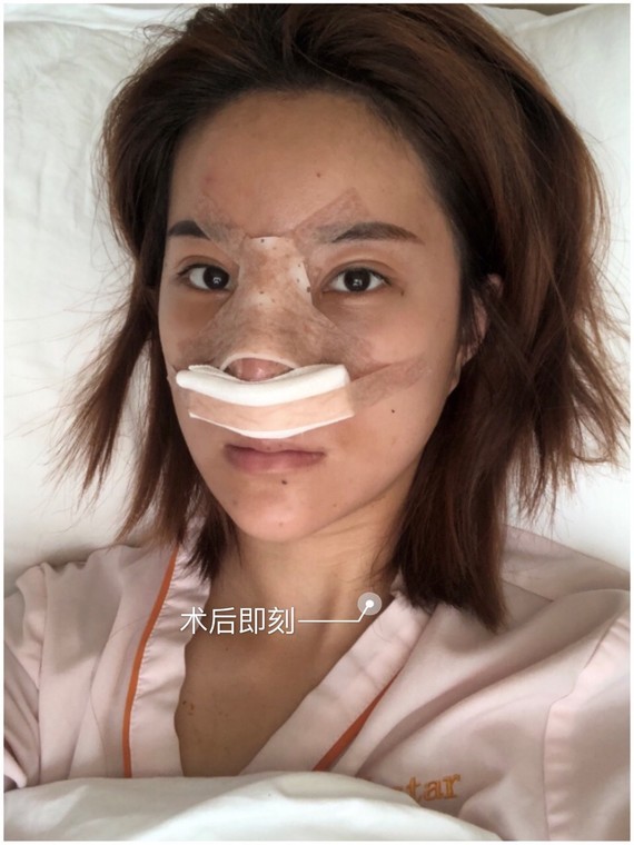 3 小时 术前照片