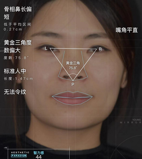 8°,略大于93%的人群;1,中庭偏短,中下庭0.