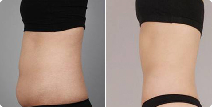 venus freeze 磁雕精灵