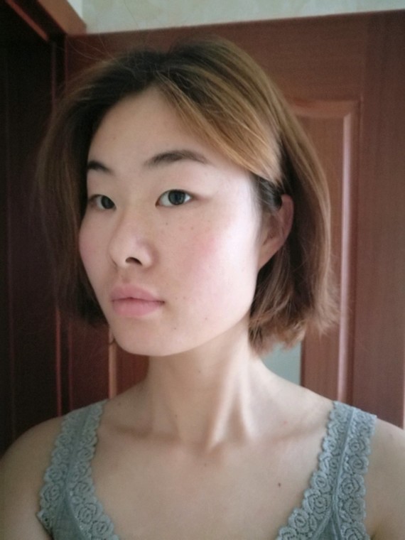 我是单眼皮,又是大小眼,一直看着好像无神,这个开双眼皮要开