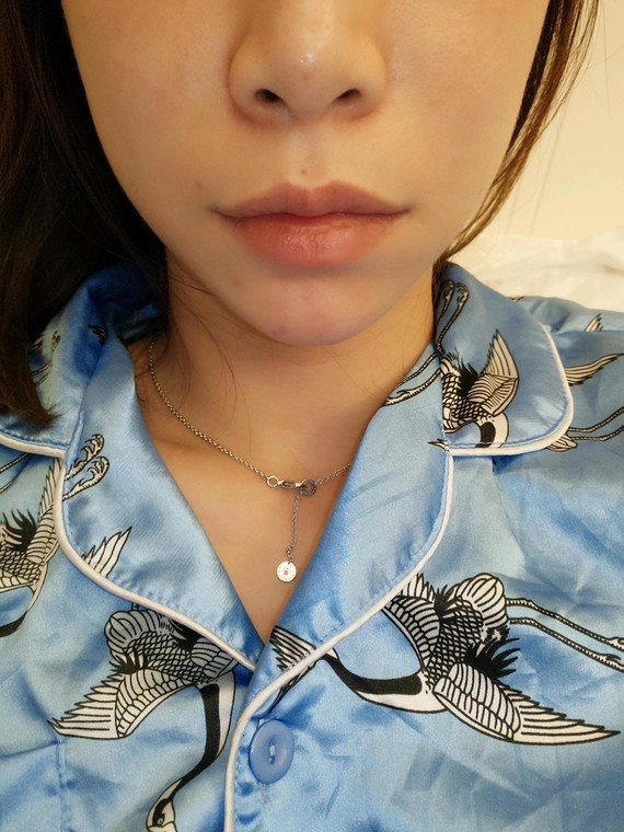 颌面矫正手术是个笼统的说法,具体分为上颌前